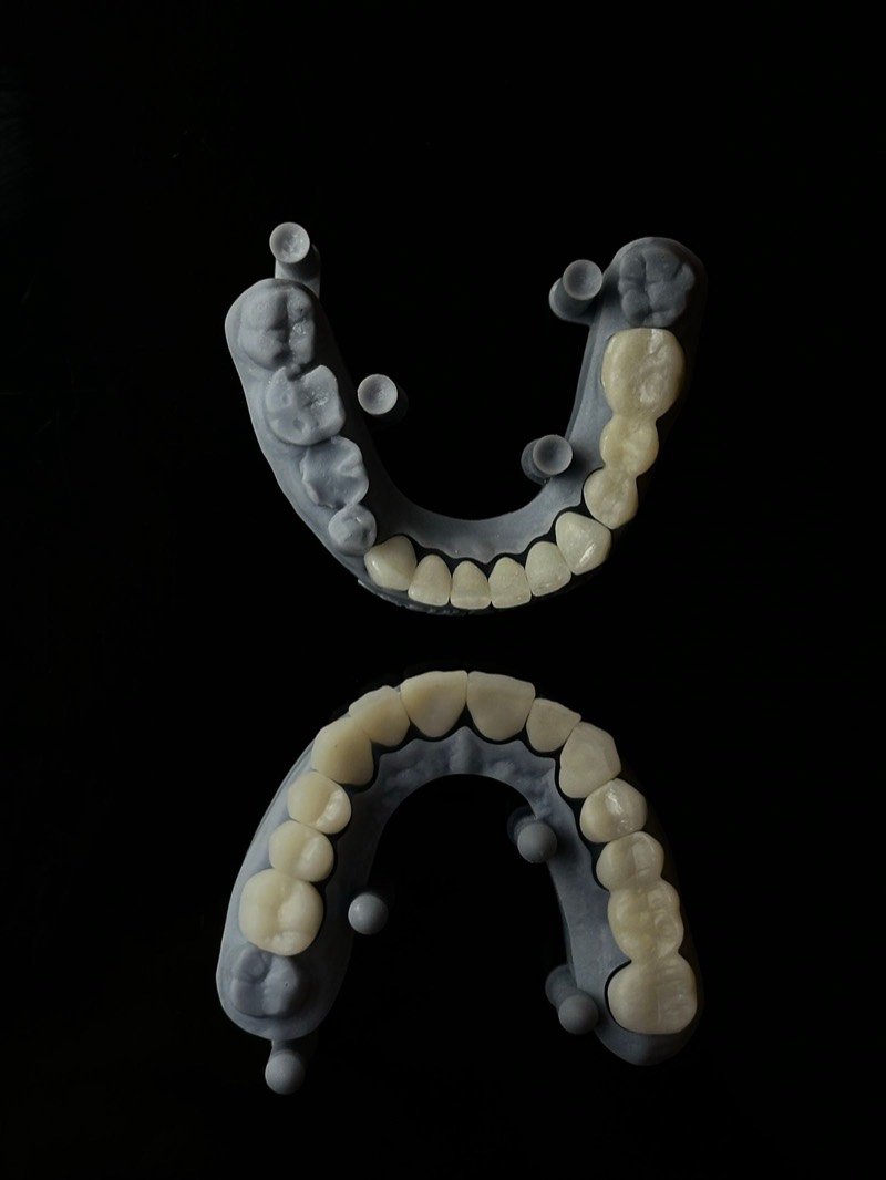 Modelos dentales en resina